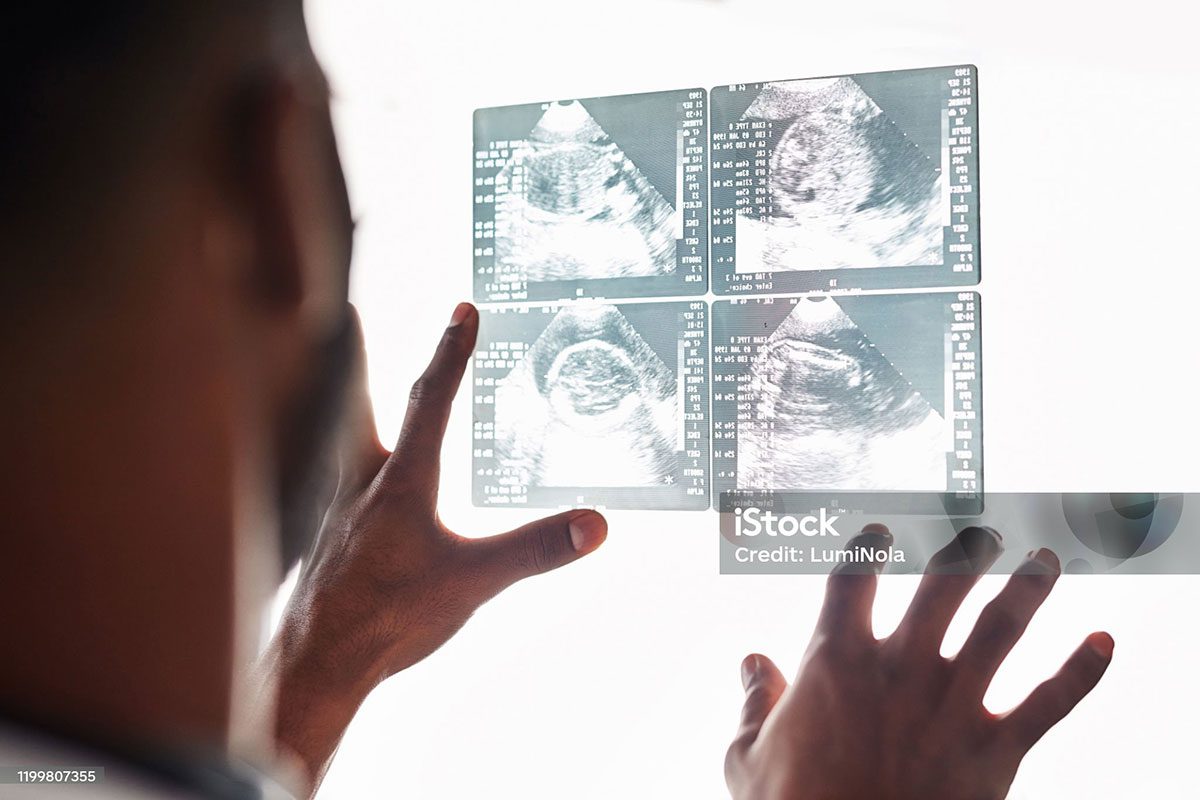 istockphoto-1199807355-2048x2048-min